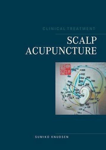 9788743033707 Scalp Acupuncture Sumiko Knudsen, Verzenden, Nieuw, Sumiko Knudsen