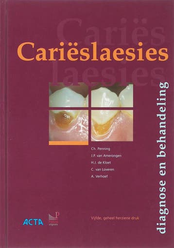 Carieslaesies 9789085620471, Verzenden, Zo goed als nieuw