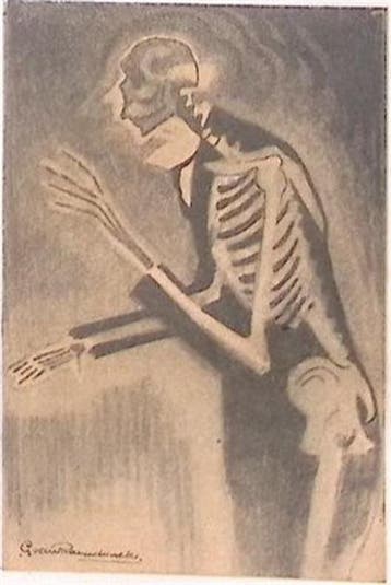 X-stralen (lijst optie, Lithos), Verzenden