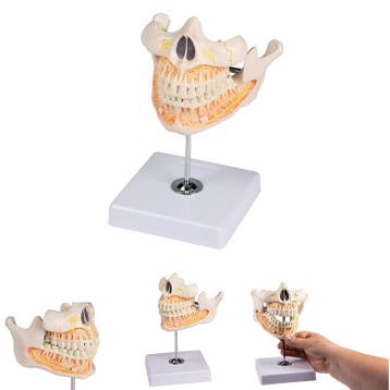 Anatomie model volwassen gebit, 11x11x12 cm, Nieuw