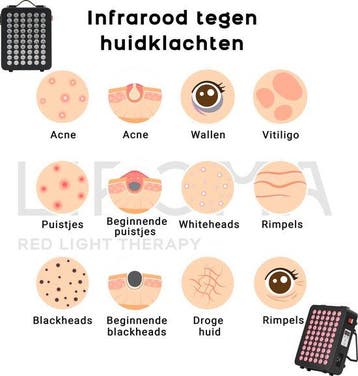 2dekans | LIROMA® Roodlichttherapie - 2 Golflengten - Timer, Ophalen of Verzenden, Zo goed als nieuw