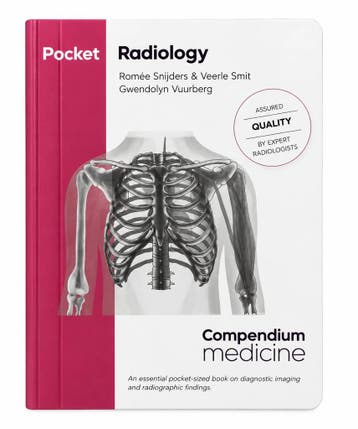 Boek Pocket Radiology, Verzenden, Nieuw