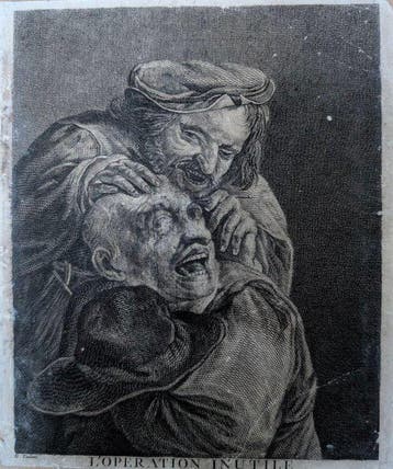 David Teniers le Jeune (1610–1690), after - Lopération