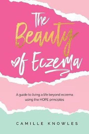 The Beauty of Eczema - Camille Knowles 9781725619302, Verzenden, Zo goed als nieuw, Camille Knowles