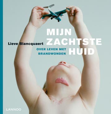 Mijn zachtste huid - Lieve Blancquaert 9789020986143, Verzenden, Gelezen, Lieve Blancquaert