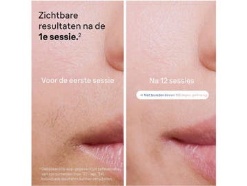 Braun Smart PL7253 - IPL Ontharingsapparaat - Slimme, Verzenden, Nieuw