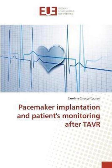 9783841615077 Pacemaker implantation and patients monito..., Verzenden, Nieuw, Caroline Chong-Nguyen